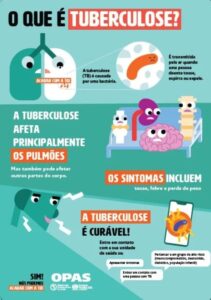 tuberculose