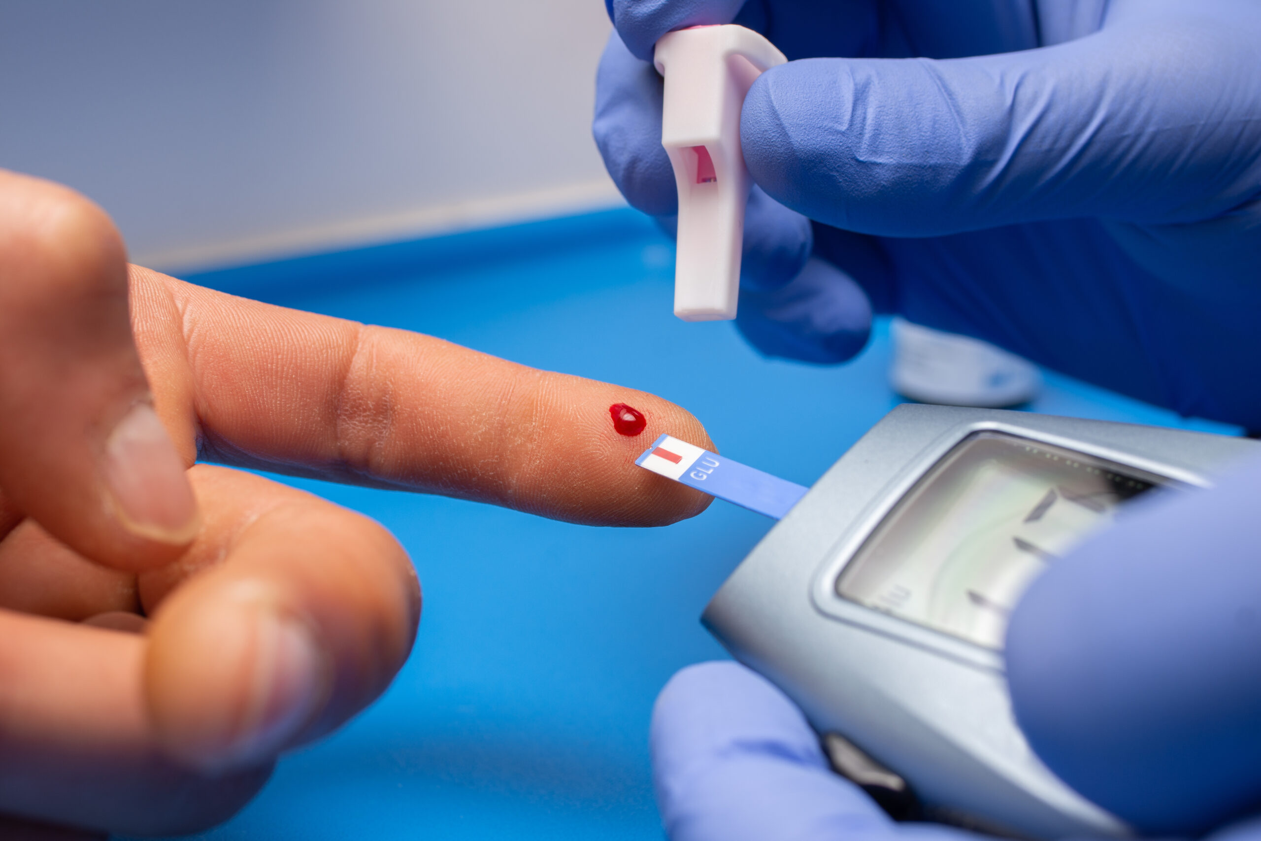 7 em cada 10 pacientes descobrem a diabetes após complicações
